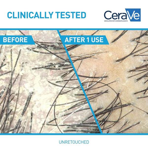 CeraVe Anti-Dandruff Hydrating Shampoo #3