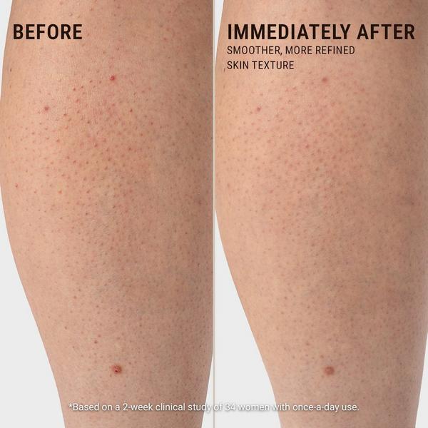 VOESH Body Buffing Bar #4