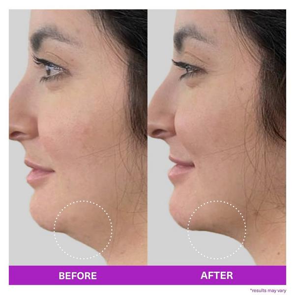 SickScience Labs ShapeShift Advanced Jaw & Neck Firming Serum #4