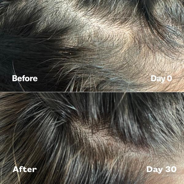 SickScience Labs PowerCycle Scalp Treatment Serum #5