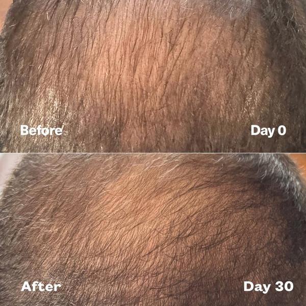 SickScience Labs PowerCycle Scalp Treatment Serum #6