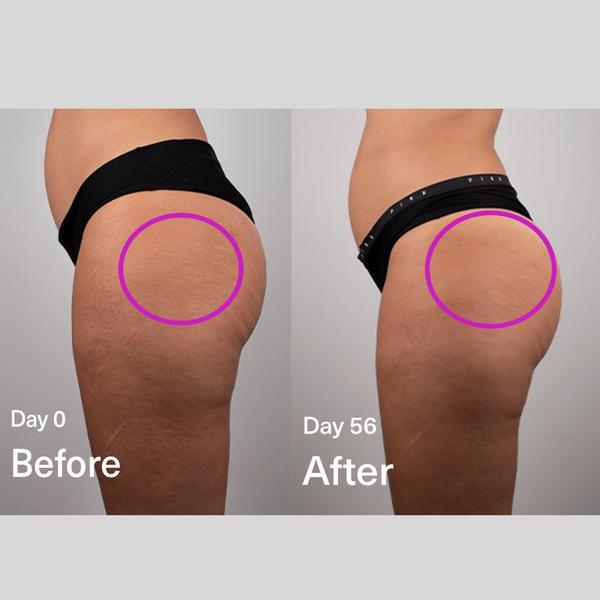 SickScience Labs DropOff Body Sculpting Serum #4