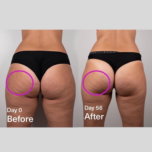 SickScience Labs DropOff Body Sculpting Serum #5