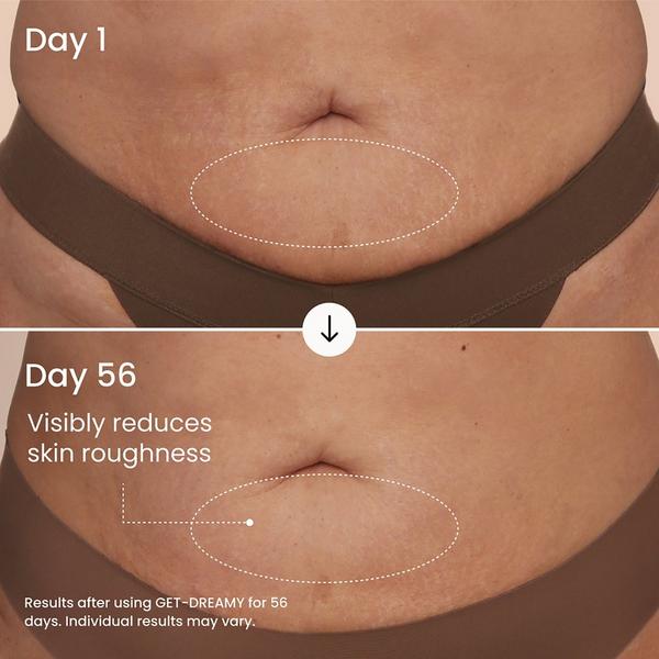 MAËLYS GET-DREAMY Overnight Toning Body Whip #5