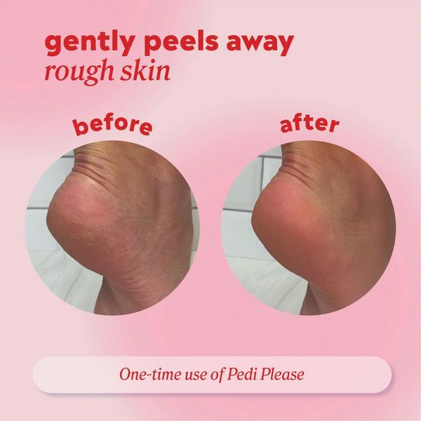 ONYX Professional  Pedi Please Quick Peeling Foot Mask #5