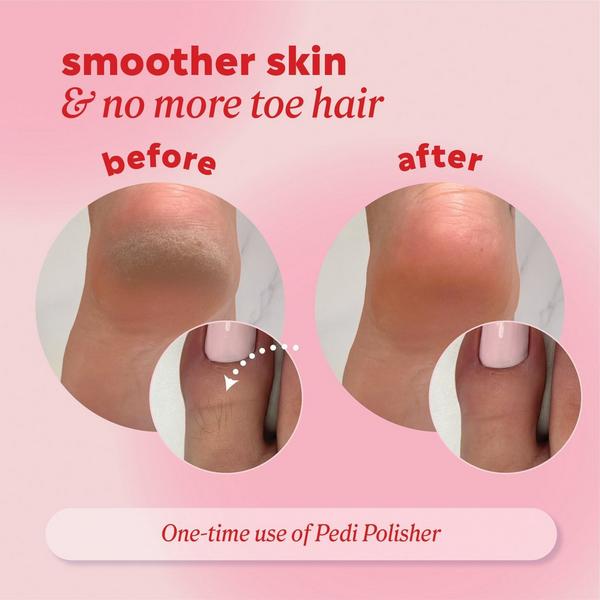 ONYX Professional  Pedi Polisher 2-1 Nano Glass Exfoliator #5