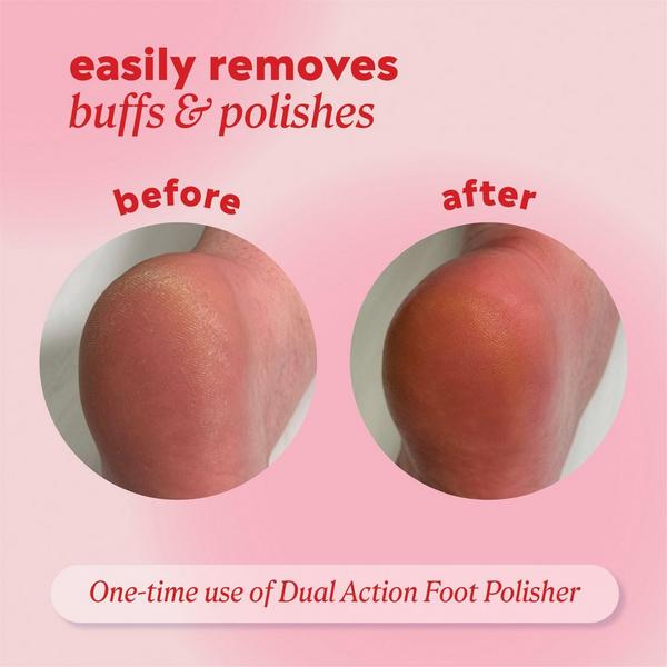 ONYX Professional  Dual Action Foot Polisher #4