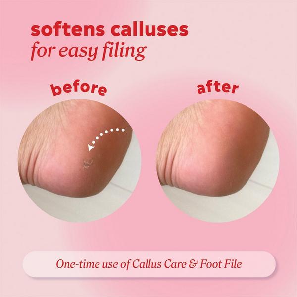 ONYX Professional  Callus Care Callus & Corn Peeling Gel #4