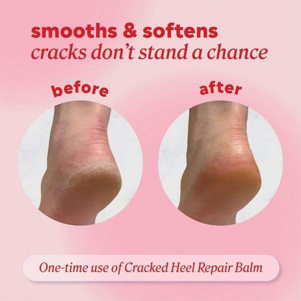 ONYX Professional  Cracked Heel Repair Balm #4