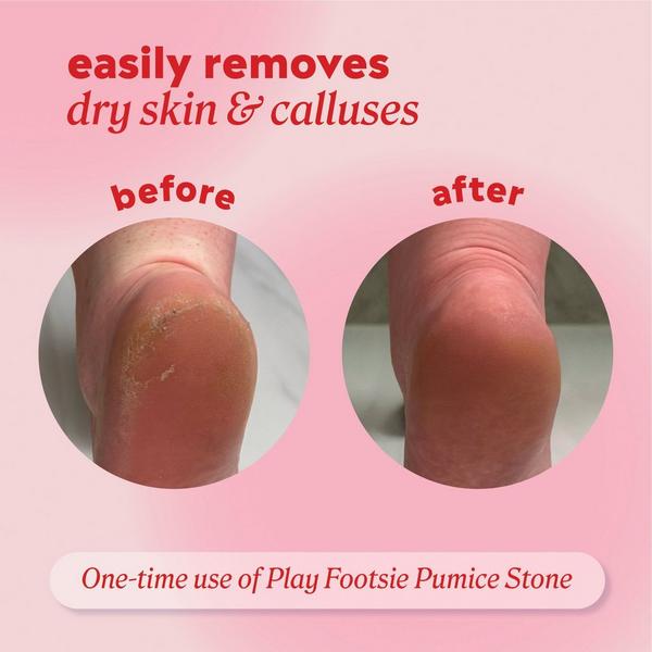 ONYX Professional  Play Footsie Double-Sided Pumice Stone #4