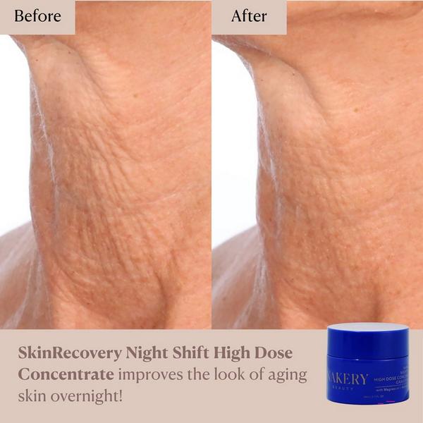 NAKERY BEAUTY SkinRecovery Night Shift High Dose Concentrate Gravity Reset #8