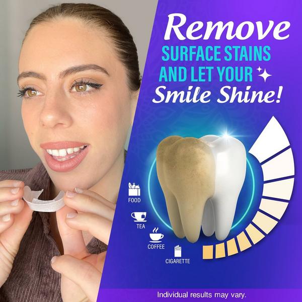 GuruNanda Professional Ready-To-Use Whitening Trays #5