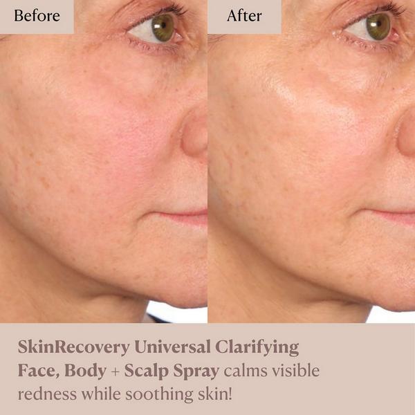 NAKERY BEAUTY SkinRecovery Universal Clarifying Face, Body + Scalp Spray #5