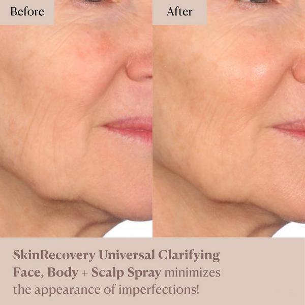 NAKERY BEAUTY SkinRecovery Universal Clarifying Face, Body + Scalp Spray #6