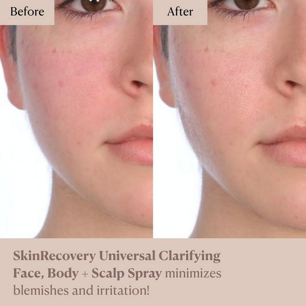 NAKERY BEAUTY SkinRecovery Universal Clarifying Face, Body + Scalp Spray #7