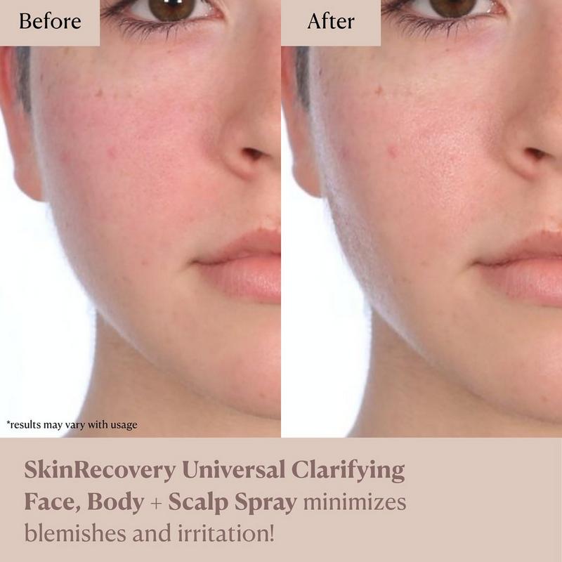 NAKERY BEAUTY - SkinRecovery Universal Clarifying Face, Body +