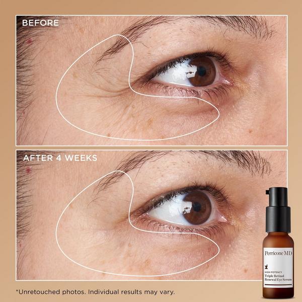 Perricone MD High Potency Triple Retinol Power Kit #3