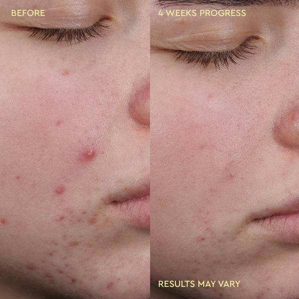BYOMA Blemish Acne Clearing Creamy Cleanser #5