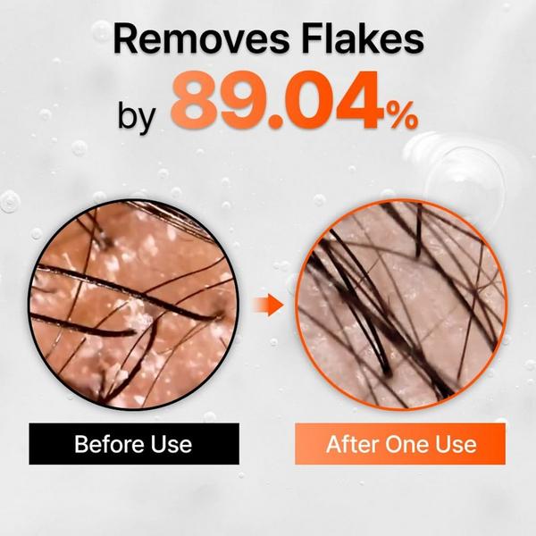 Lilyeve GrowTurn Exosome Hair Serum #5