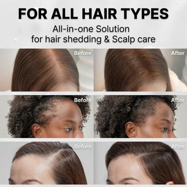 Lilyeve GrowTurn Exosome Hair Serum #7