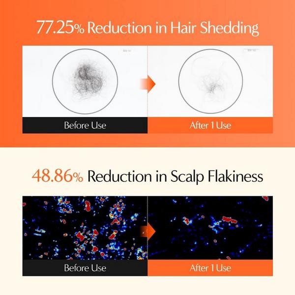 Lilyeve GrowTurn 3D Volume Hair Shampoo #6