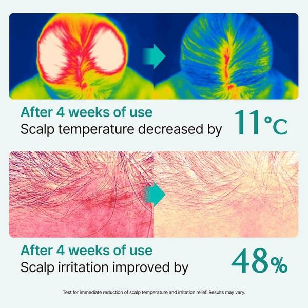 Lilyeve ScalpTurn Cica PDRN Serum #5