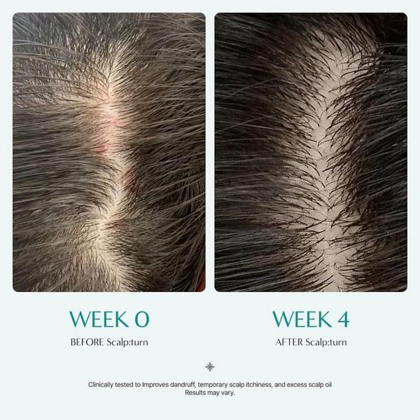 Lilyeve ScalpTurn Cica PDRN Serum #7