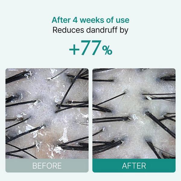 Lilyeve ScalpTurn Cica PDRN Serum #8