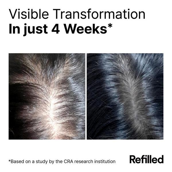 Refilled Cytokine Booster Pro Daily Scalp Serum Refill Set #5