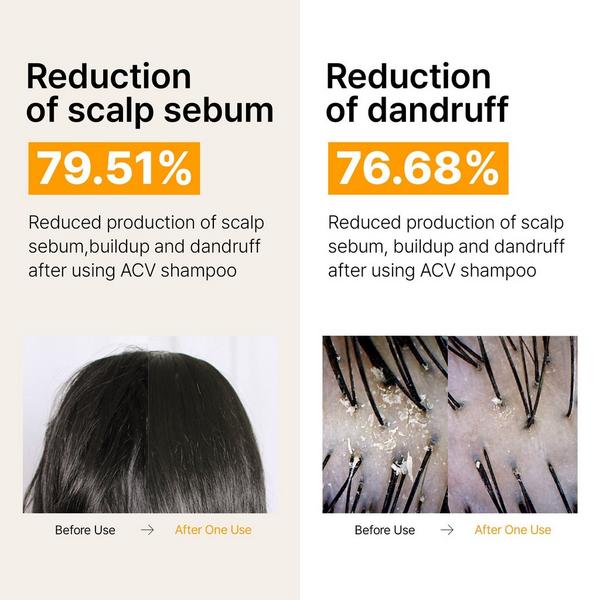 LADOR ACV Vinegar Clarifying Shampoo #5