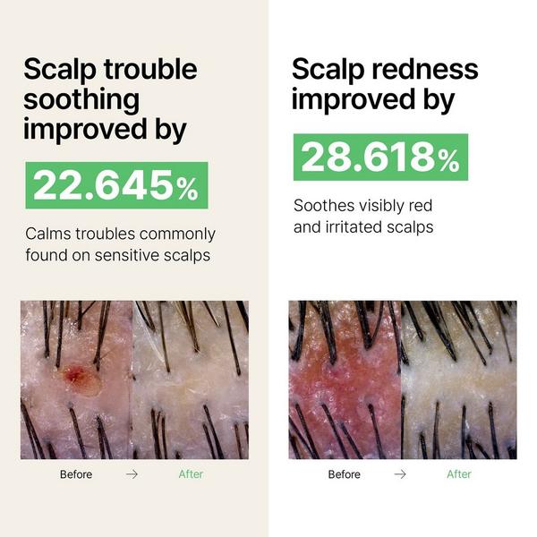 LADOR Tea Tree Calming Scalp Dry Shampoo #5