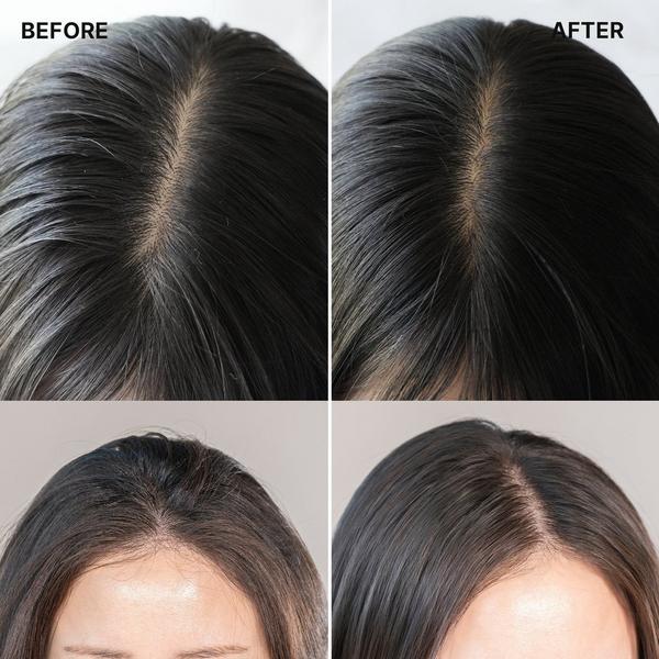 LADOR Tea Tree Calming Scalp Dry Shampoo #6