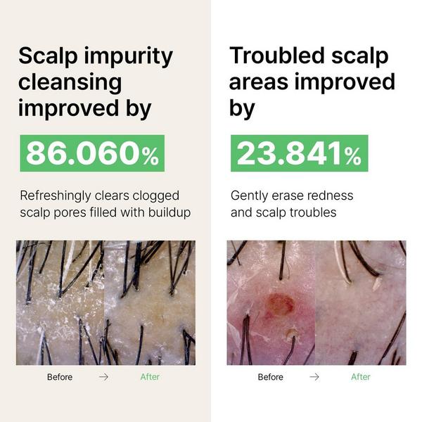 LADOR Tea Tree Calming Scalp Shampoo #6