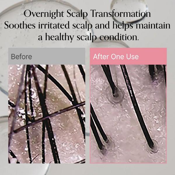 GROWUS Damage Therapy Scalp Hydrating + Exfoliating Serum #5