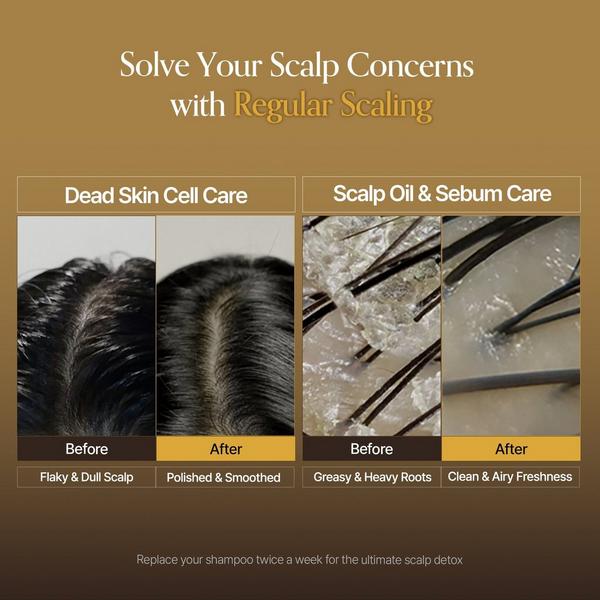 GROWUS Sea Salt Therapy Exfoliating Scalp Scaler #5