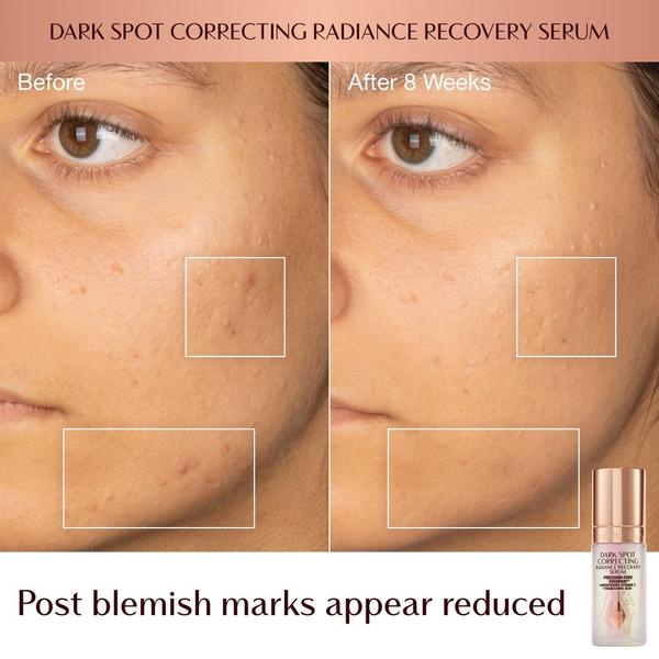 Charlotte Tilbury Dark Spot Correcting Hydration Revival Duo  #4