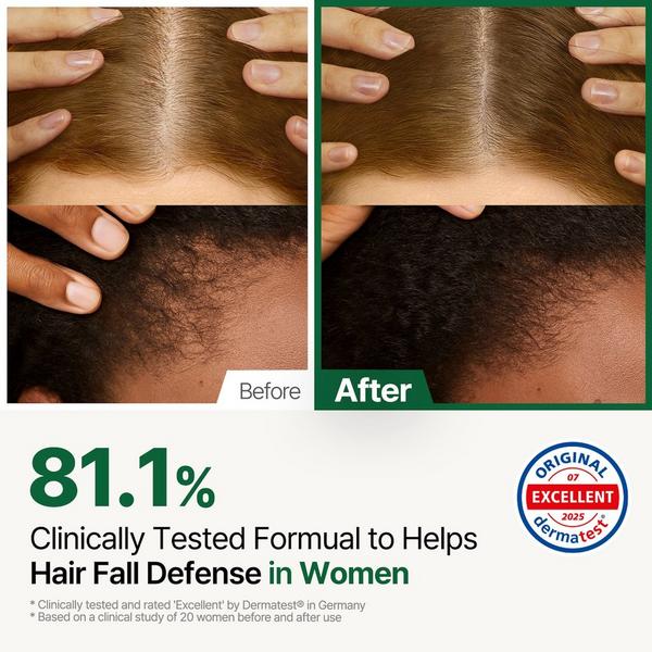 ROOTON Alpha Erguen Treatment #3