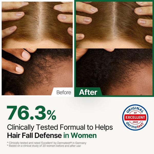 ROOTON Alpha Erguen Hair Tonic #3