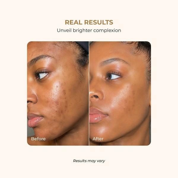 Buttah Skin 6 Piece Glow Essentials Skincare Travel Set #5