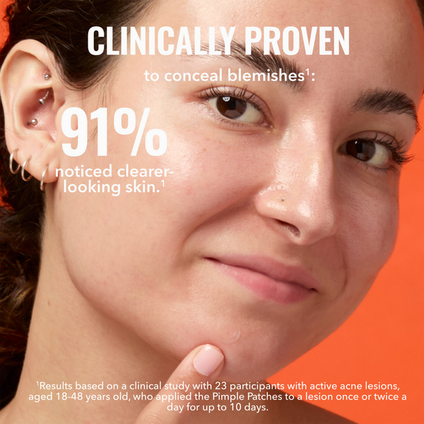 Good Molecules Pimple Patches #3