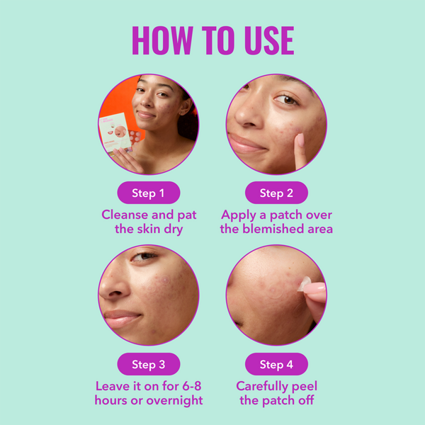 Good Molecules Pimple Patches #4