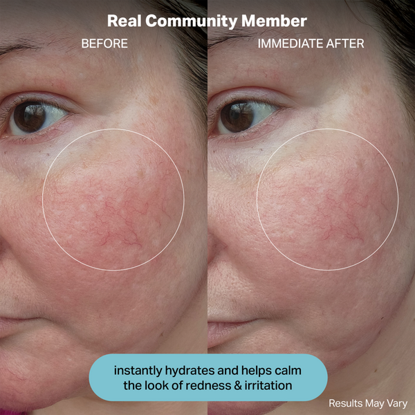 cocokind Hydrating Electrolyte Rescue Serum #4