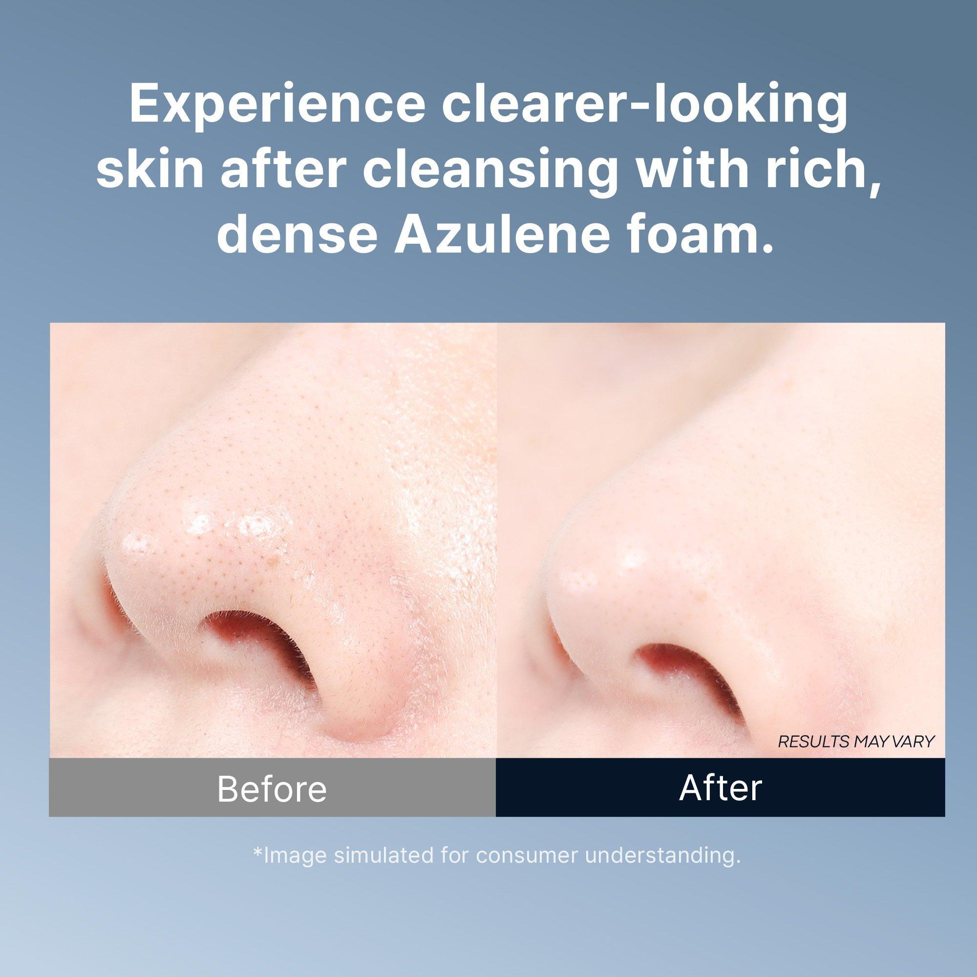 Пенка для умывания Tonymoly Azulene Anti Blemish против акне — фото 7