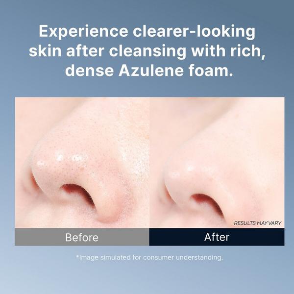 TONYMOLY Azulene Anti Blemish Acne Foam Cleanser #7