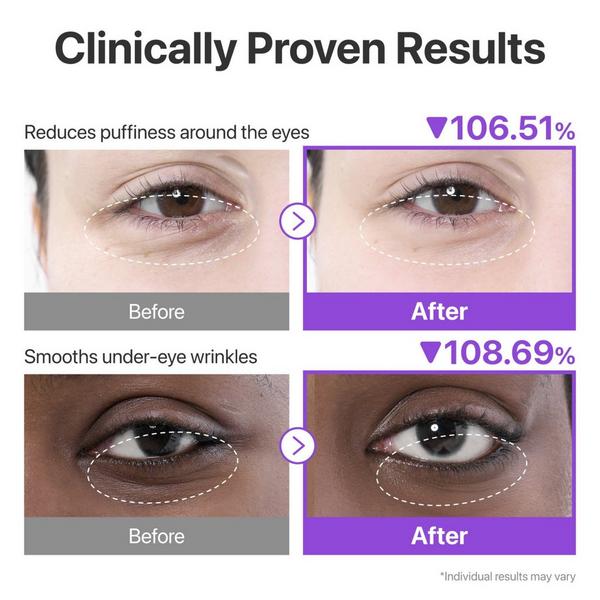 numbuzin No.9 NAD+ Collagen Under Eye Patch #3