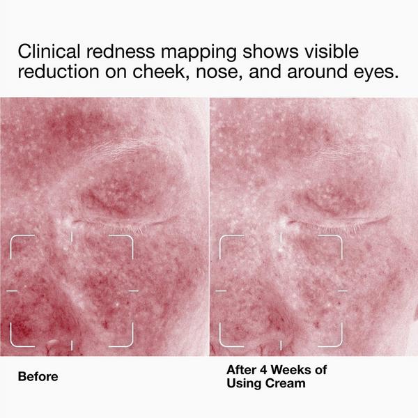 Clinique Daily Calm Soothing Repair Face Cream #3