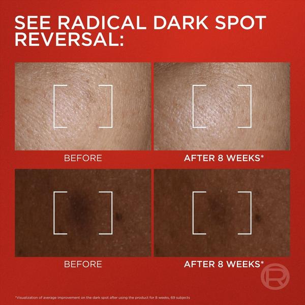L'Oréal Revitalift Melasyl Dark Spot Creamy - Serum #3