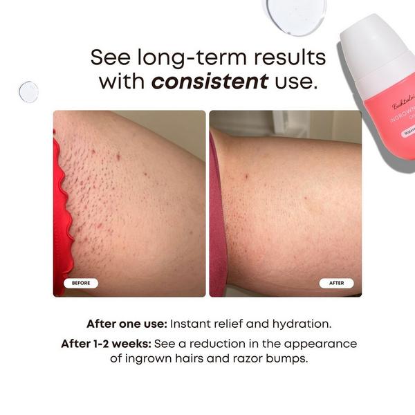 Bushbalm Mini Ingrown Hair Oil #2