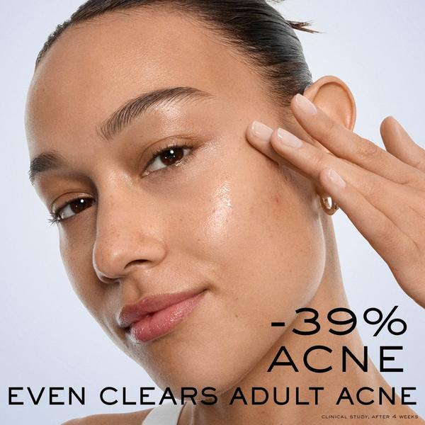 Lancôme Clarifique Bx-Interceptor Acne Treatment with Glycolic & Salicylic Acid #3