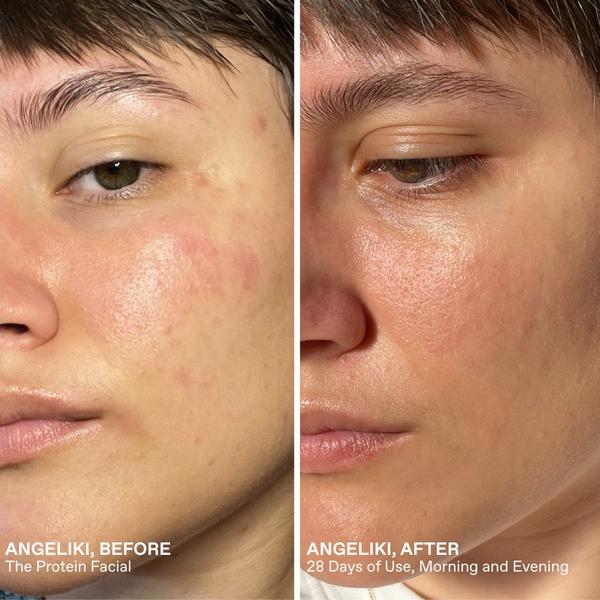 KORRES Greek Yoghurt Protein Facial Set #5